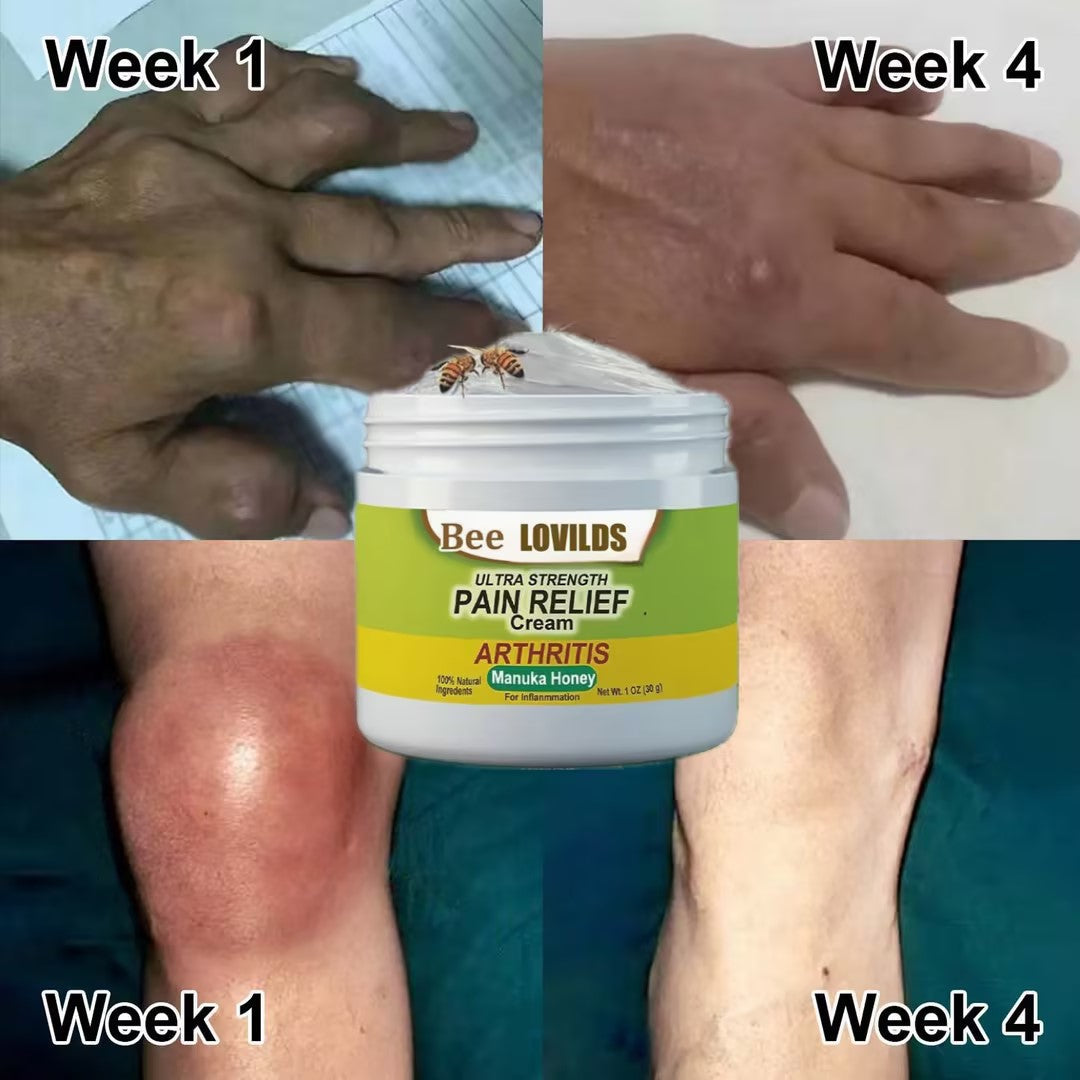 【Official Brand Store】LOVILDS™ New Zealand Bee-Infused Joint and Bone Therapy Advanced Cream